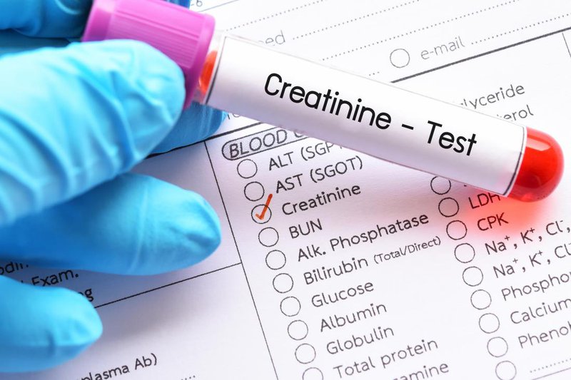 Xét nghiệm creatinine máu để chẩn đoán bệnh suy thận